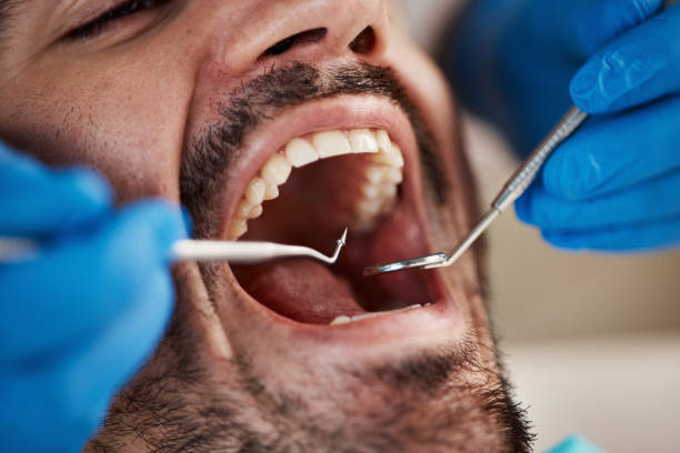 Best Urgent Care for Lost Fillings or Crowns in , NJ