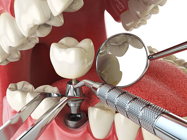 Best Emergency Dental Care for Broken or Chipped Teeth in , NJ
